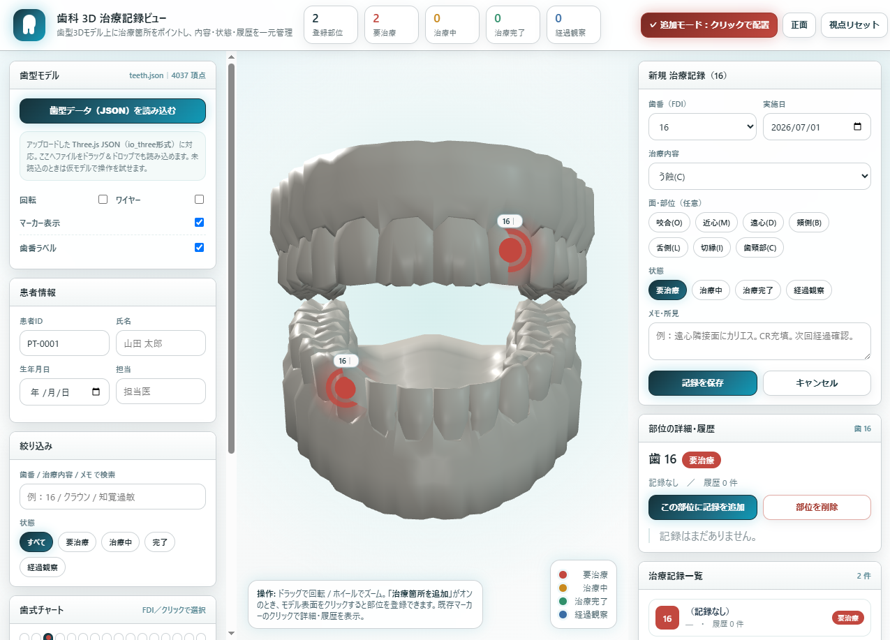 歯科診療クリニック 3D治療記録ビュー｜歯式・口腔内3Dモデル・治療履歴管理システム